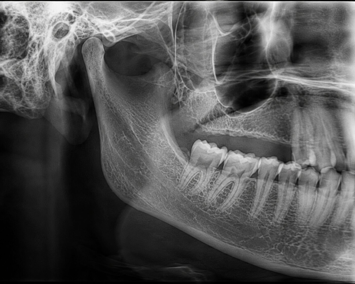 Lateral jaw radiograph